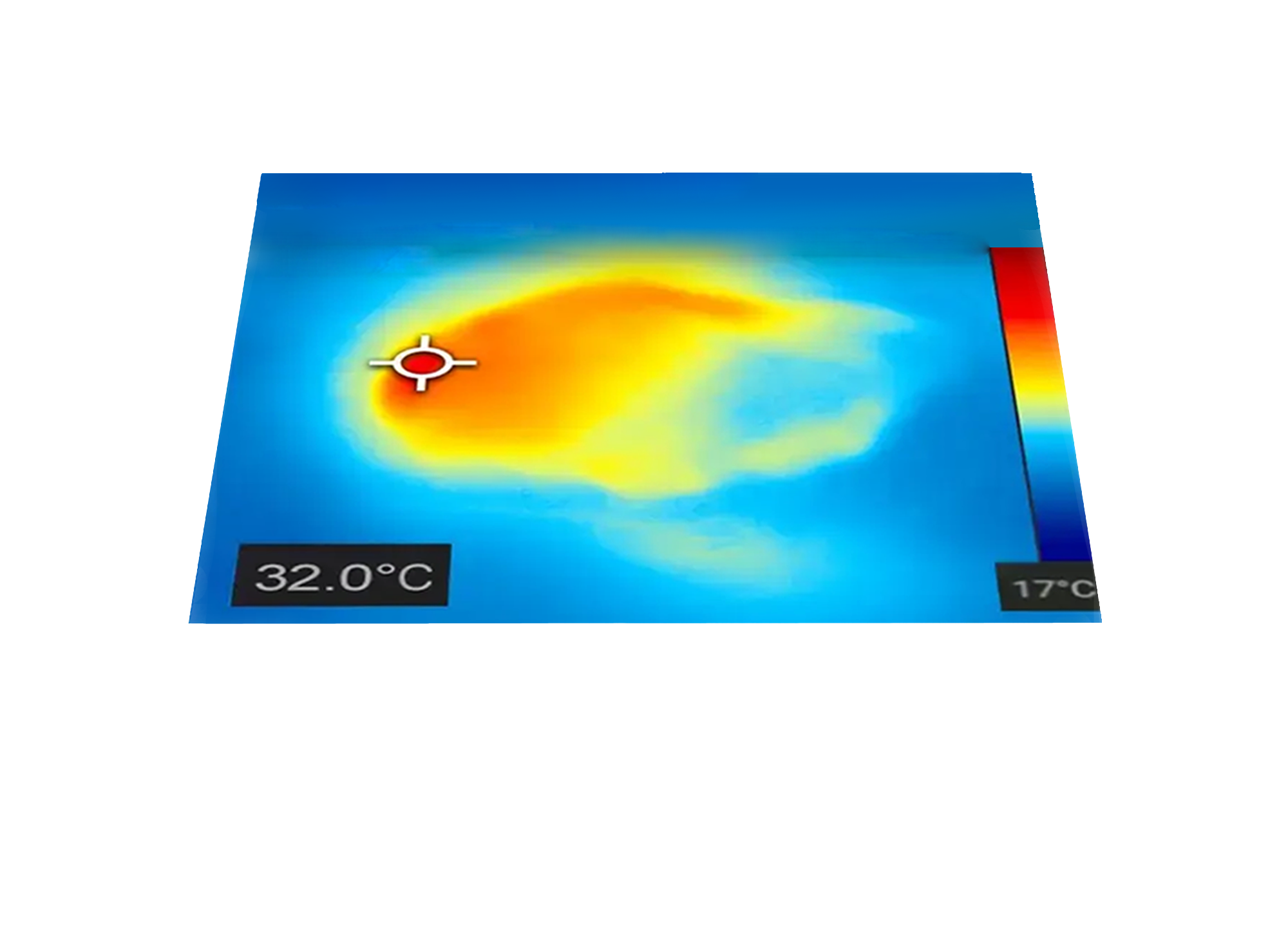 Messung der Wundtemperatur